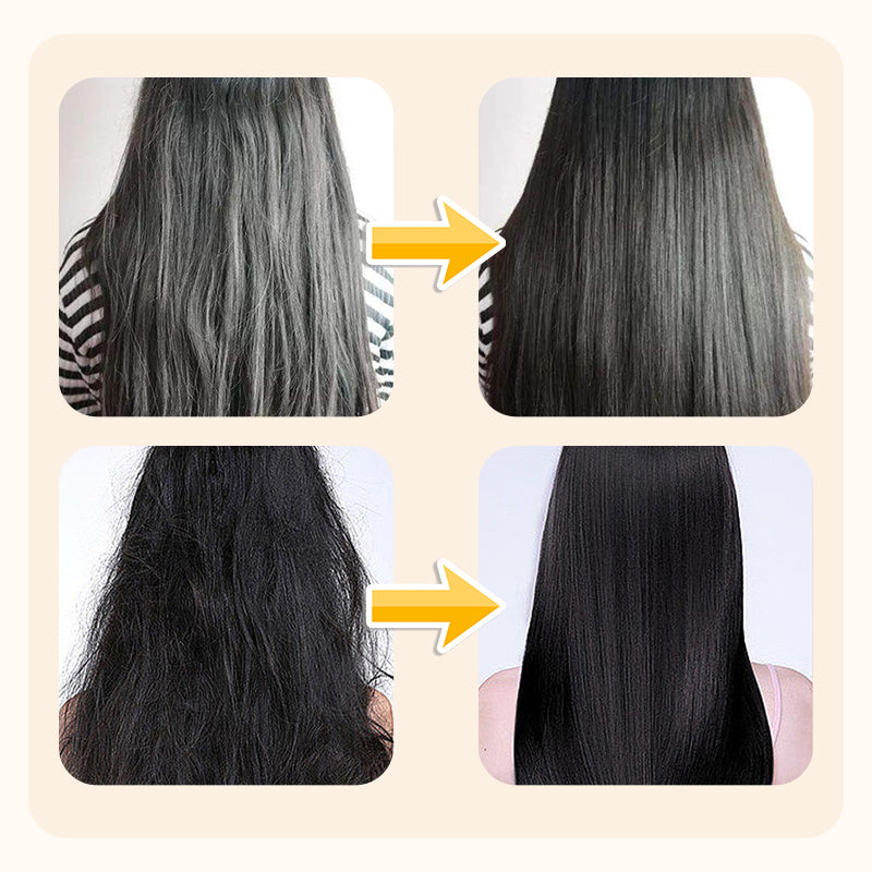 Rice Water Anti-Dandruff Shampoo